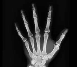 Rose Garden Nursing And Rehabilitation Center