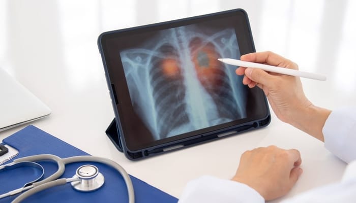 National Jewish Health