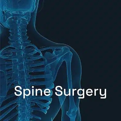 Graphic of a spine with text related to surgery