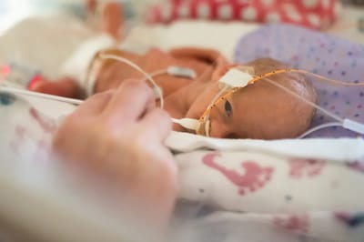 A baby on medical equipment in a hospital setting