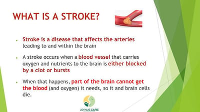 Information about stroke and its effects.