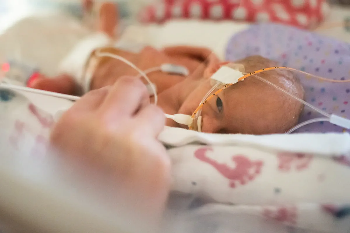 A baby on medical equipment in a hospital setting
