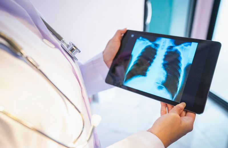 Medical professional displaying an X-ray on a tablet