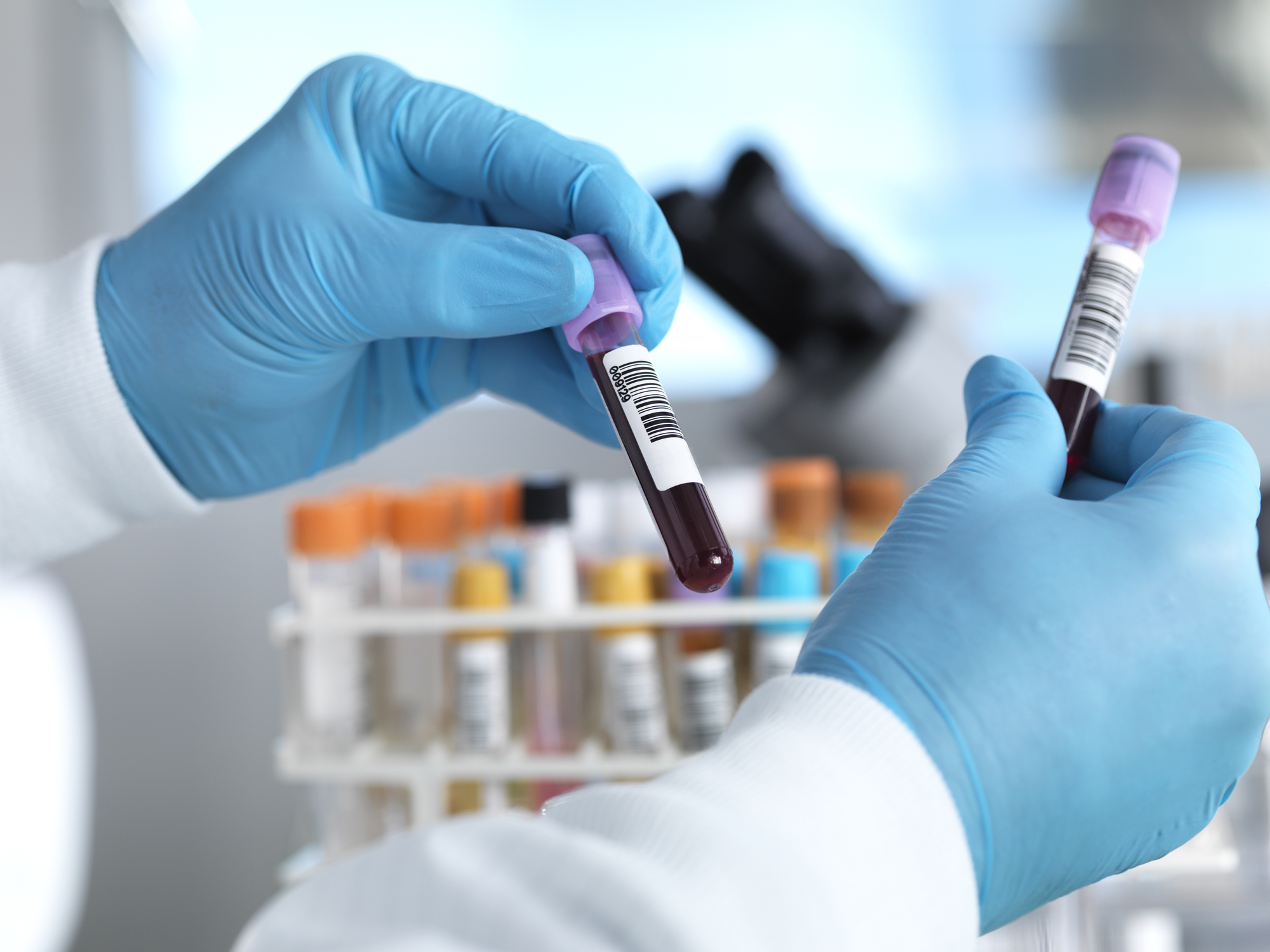 Laboratory scene with blood sample test tubes